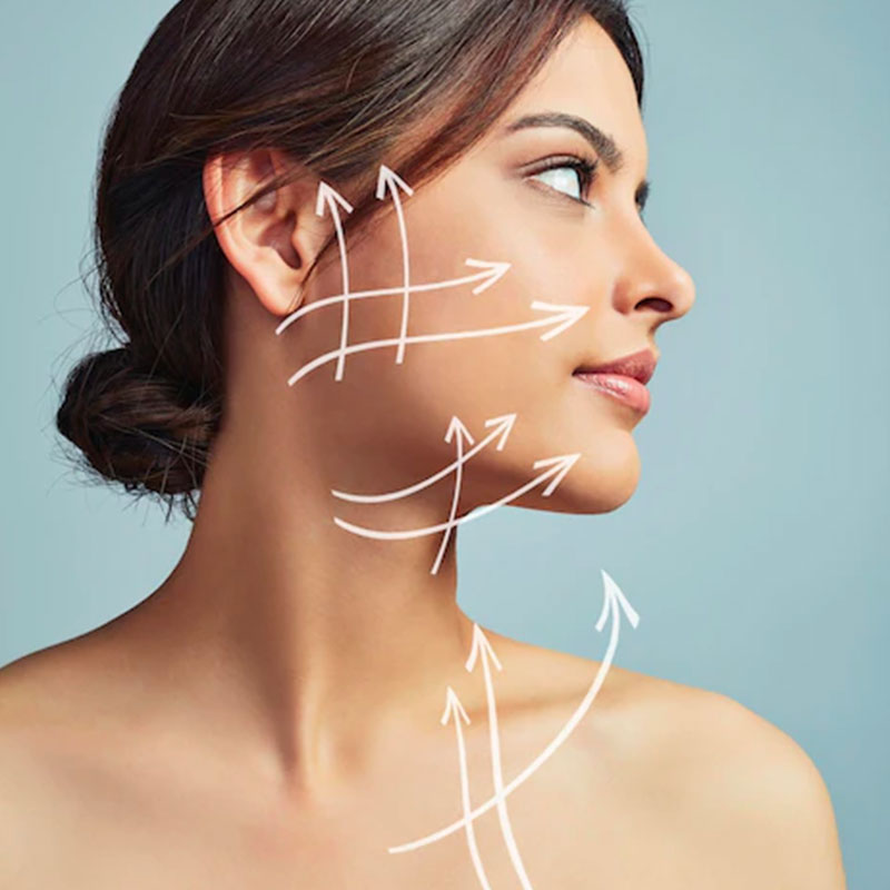 Medico specializzato in medicina estetica - fili di sospensione