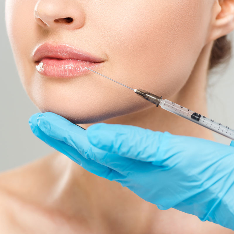 filler labbra medicina estetica